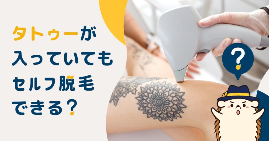 妊娠中のレーザー技師が仕事を続けても安全ですか?